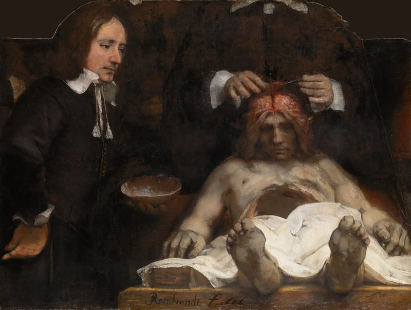 A Lição de Anatomia do Doutor Joan Deyman - Rembrandt